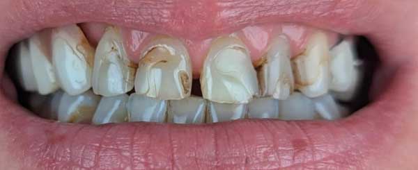 before and after case 3 - before