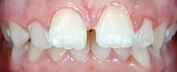 before and after case 4 - before